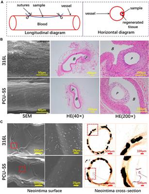 Sulfur-Mediated Polycarbonate Polyurethane for Potential Application of Blood-Contacting Materials